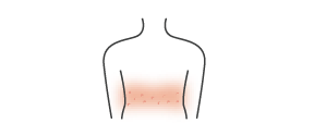 *