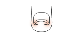 *
